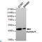 Aurora Kinase A antibody, LS-C812884, Lifespan Biosciences, Western Blot image 
