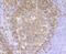 CD79a antibody, A01047-2, Boster Biological Technology, Immunohistochemistry paraffin image 