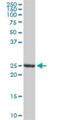 Glutathione S-transferase A3 antibody, H00002940-D01P, Novus Biologicals, Western Blot image 