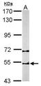 Chaperonin Containing TCP1 Subunit 2 antibody, NBP1-33418, Novus Biologicals, Western Blot image 