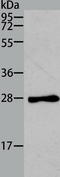 Troponin I3, Cardiac Type antibody, TA323685, Origene, Western Blot image 