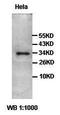 2-aminoethanethiol dioxygenase antibody, orb77498, Biorbyt, Western Blot image 