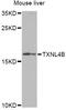 Thioredoxin Like 4B antibody, A13142, Boster Biological Technology, Western Blot image 