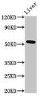 Methionyl Aminopeptidase 2 antibody, LS-C674992, Lifespan Biosciences, Western Blot image 