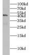MAF BZIP Transcription Factor B antibody, FNab04930, FineTest, Western Blot image 