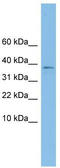 Kelch Domain Containing 9 antibody, TA339946, Origene, Western Blot image 
