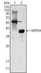 Megakaryocyte-Associated Tyrosine Kinase antibody, A02050, Boster Biological Technology, Western Blot image 