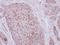 Zona Pellucida Glycoprotein 2 antibody, LS-C155477, Lifespan Biosciences, Immunohistochemistry paraffin image 