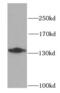 Cadherin 2 antibody, FNab05569, FineTest, Western Blot image 