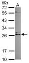 IMP U3 Small Nucleolar Ribonucleoprotein 3 antibody, PA5-31673, Invitrogen Antibodies, Western Blot image 
