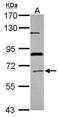 Peroxisomal acyl-coenzyme A oxidase 1 antibody, GTX110372, GeneTex, Western Blot image 