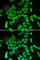 Iron regulatory protein 2 antibody, A6382, ABclonal Technology, Immunofluorescence image 