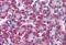 Deoxyuridine 5 -triphosphate nucleotidohydrolase antibody, orb86869, Biorbyt, Immunohistochemistry paraffin image 