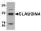 BCL6 Transcription Repressor antibody, orb75829, Biorbyt, Western Blot image 