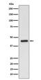 Sphingosine 1-phosphate receptor 3 antibody, M03755-1, Boster Biological Technology, Western Blot image 