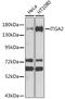 Integrin Subunit Alpha 2 antibody, GTX35237, GeneTex, Western Blot image 