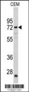 Carnitine O-Acetyltransferase antibody, 62-328, ProSci, Western Blot image 