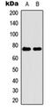 Cytochrome P450 11B2, mitochondrial antibody, orb234817, Biorbyt, Western Blot image 
