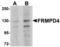 Transmembrane Protein 94 antibody, TA306865, Origene, Western Blot image 