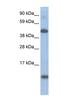 Ligand Dependent Nuclear Receptor Corepressor antibody, NBP1-80260, Novus Biologicals, Western Blot image 