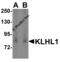 Kelch Like Family Member 1 antibody, 3015, ProSci, Western Blot image 