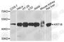 Keratin 18 antibody, A0389, ABclonal Technology, Western Blot image 
