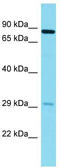Neuronal Tyrosine-Phosphorylated Phosphoinositide-3-Kinase Adaptor 2 antibody, TA337385, Origene, Western Blot image 