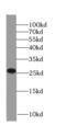 Amyloid P Component, Serum antibody, FNab07757, FineTest, Western Blot image 
