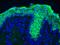 Keratin 10 antibody, MA1-06319, Invitrogen Antibodies, Immunohistochemistry paraffin image 