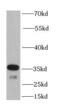 8-Oxoguanine DNA Glycosylase antibody, FNab05980, FineTest, Western Blot image 