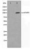 Glutamate Metabotropic Receptor 8 antibody, TA347393, Origene, Western Blot image 