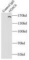 Histone Deacetylase 6 antibody, FNab03803, FineTest, Immunoprecipitation image 