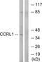 Atypical Chemokine Receptor 4 antibody, A30564, Boster Biological Technology, Western Blot image 