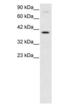 DNA/RNA-binding protein KIN17 antibody, PA1-24441, Invitrogen Antibodies, Western Blot image 