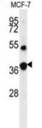 FBP antibody, abx033366, Abbexa, Western Blot image 