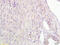 Alpha Fetoprotein antibody, GTX60214, GeneTex, Immunohistochemistry paraffin image 