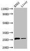 N-Ribosyldihydronicotinamide:Quinone Reductase 2 antibody, orb400516, Biorbyt, Western Blot image 
