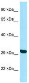 TATA box-binding protein-like protein 2 antibody, TA337706, Origene, Western Blot image 