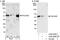 DNA-directed RNA polymerase III subunit RPC4 antibody, A302-295A, Bethyl Labs, Immunoprecipitation image 
