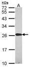 Peroxiredoxin 2 antibody, NBP2-19776, Novus Biologicals, Western Blot image 