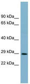 DCN1-like protein 1 antibody, TA329449, Origene, Western Blot image 