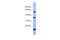 La Ribonucleoprotein Domain Family Member 6 antibody, ARP40912_P050, Aviva Systems Biology, Western Blot image 