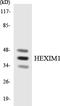 HEXIM P-TEFb Complex Subunit 1 antibody, LS-C292052, Lifespan Biosciences, Western Blot image 