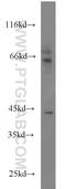 Alpha-2-Glycoprotein 1, Zinc-Binding antibody, 13399-1-AP, Proteintech Group, Western Blot image 
