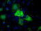 Proteasome 26S Subunit, ATPase 3 antibody, TA500924, Origene, Immunofluorescence image 