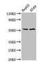 Sprouty Related EVH1 Domain Containing 1 antibody, CSB-PA773600LA01HU, Cusabio, Western Blot image 