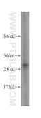 Microtubule Interacting And Trafficking Domain Containing 1 antibody, 17264-1-AP, Proteintech Group, Western Blot image 