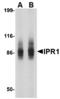 SP110 Nuclear Body Protein antibody, MBS150343, MyBioSource, Western Blot image 