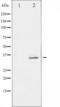 Ribosomal Protein S6 antibody, TA325819, Origene, Western Blot image 