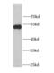 Lymphocyte-specific protein 1 antibody, FNab04879, FineTest, Western Blot image 